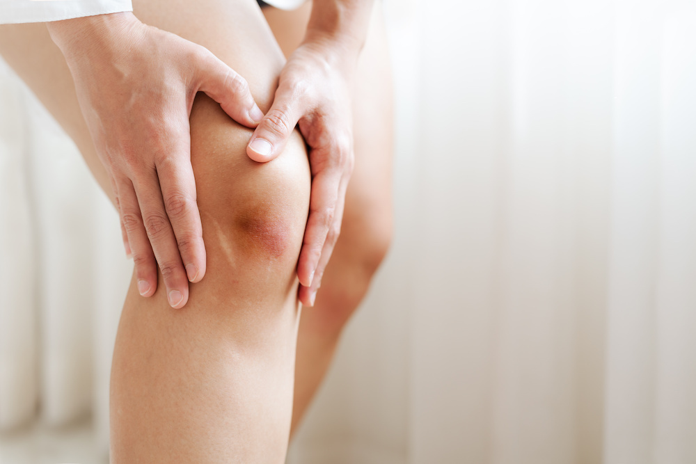膝痛・変形性膝関節症