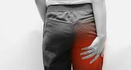 武庫之荘　梨状筋症候群とは？